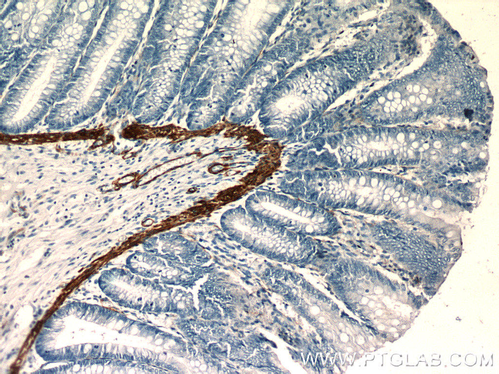 Immunohistochemistry of paraffin-embedded human colon slide using 23660-1-AP( ACTA1 Antibody) at dilution of 1:50