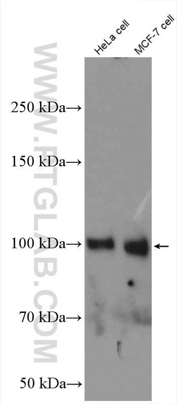 Various lysates were subjected to SDS PAGE followed by western blot with 24169-1-AP (ATF6 antibody) at dilution of 1:1000  incubated at room temperature for 1.5 hours
