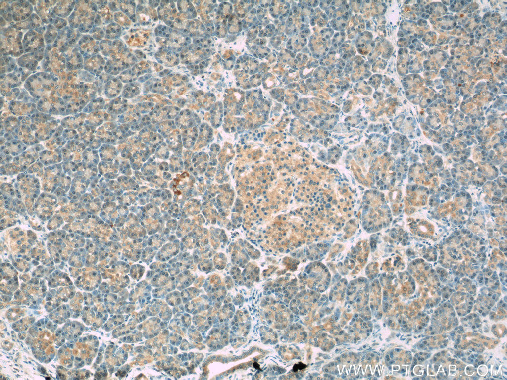Immunohistochemistry of paraffin-embedded human pancreas slide using 24390-1-AP( EIF2AK3 Antibody) at dilution of 1:50