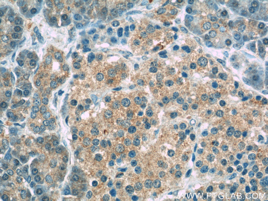 Immunohistochemistry of paraffin-embedded human pancreas slide using 24390-1-AP( EIF2AK3 Antibody) at dilution of 1:50