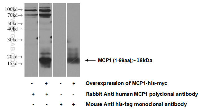 Transfected HEK-293 cells were subjected to SDS PAGE followed by western blot with 25542-1-AP( MCP1 Antibody) at dilution of 1:300  incubated at 4 degree celsius over night