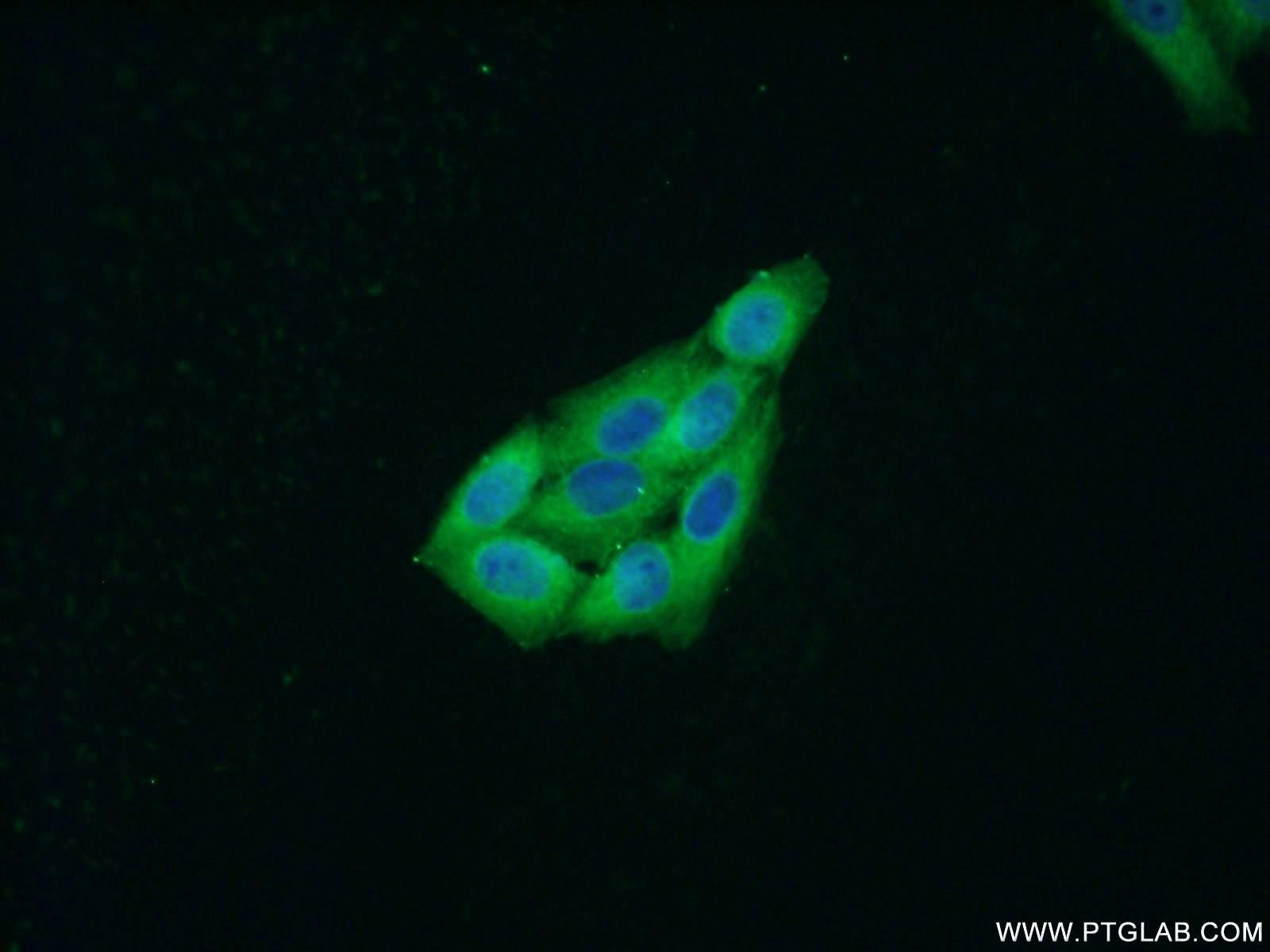 Immunofluorescent analysis of HeLa cells using 25542-1-AP( MCP1 Antibody) at dilution of 1:50 and Alexa Fluor 488-congugated AffiniPure Goat Anti-Rabbit IgG(H+L)
