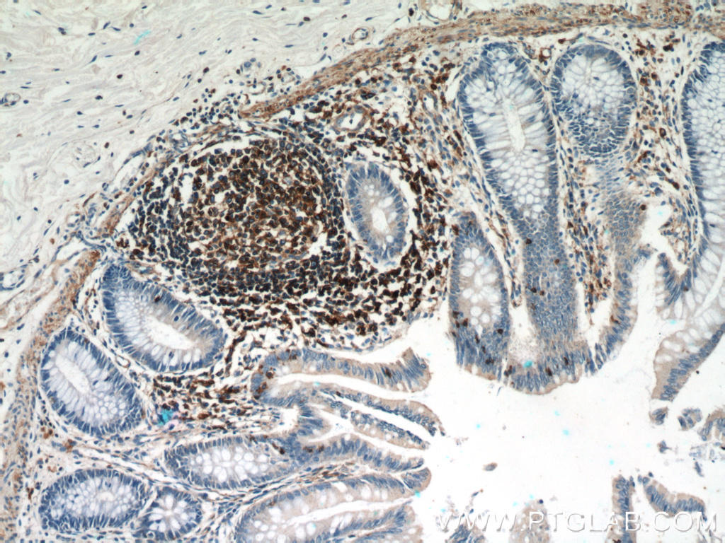 Immunohistochemical of  paraffin-embedded human colon using 60008-1-Ig(ACTB antibody) at dilution of 1:50 (under 10x lens)