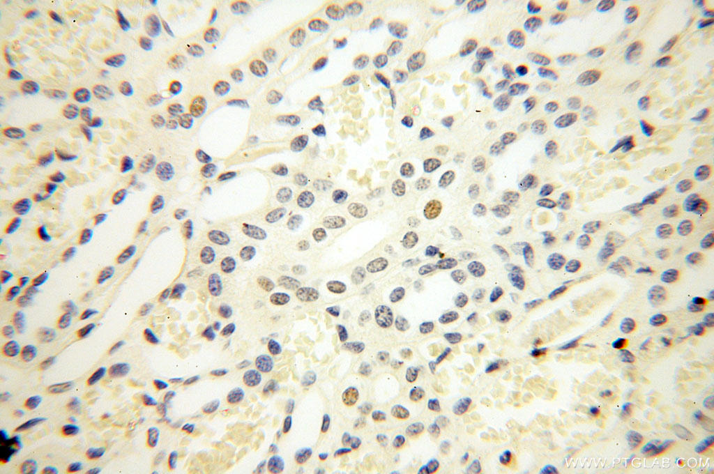 Immunohistochemical of  paraffin-embedded human kidney using 60117-2-Ig(NR2F6 antibody) at dilution of 1:50 (under 40x lens)