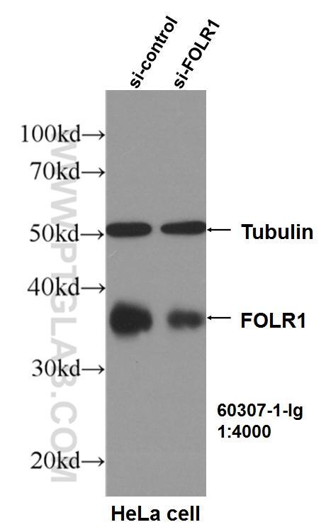WB result of FOLR1 antibody (60307-1-Ig, 1:4000) with si-Control and si-FOLR1 transfected HeLa cells. 