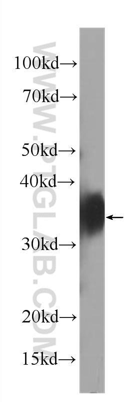 HeLa cells were subjected to SDS PAGE followed by western blot with 60307-1-Ig( FOLR1 Antibody) at dilution of 1:1000  incubated at room temperature for 1.5 hours