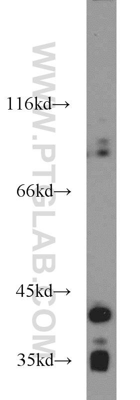 HeLa cells were subjected to SDS PAGE followed by western blot with 66034-1-Ig(NKX2-1 antibody) at dilution of 1:1000  incubated at room temperature for 1.5 hours