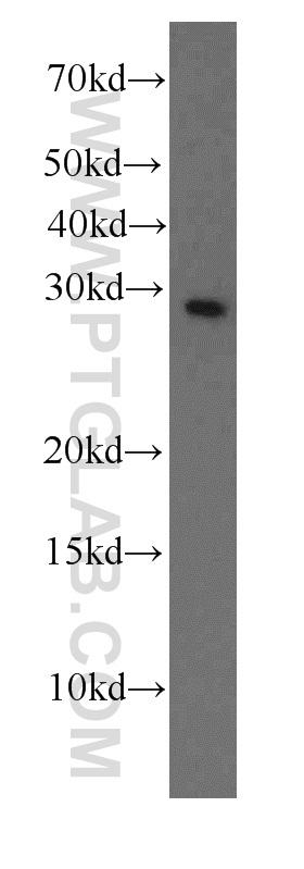 K-562 cells were subjected to SDS PAGE followed by western blot with 66089-1-Ig(F12 antibody) at dilution of 1:1000  incubated at room temperature for 1.5 hours