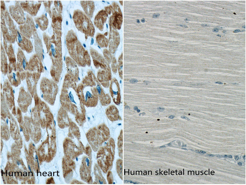 Immunohistochemistry of paraffin-embedded human heart and human skeletal muscle using 66125-1-Ig (ACTC1 specific antibody) at dilution 1:500. (under 40x lens)