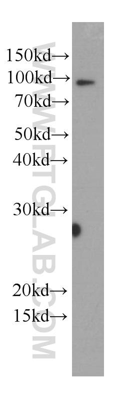 HL-60 cells were subjected to SDS PAGE followed by western blot with 66177-1-Ig( MPO Antibody) at dilution of 1:1000  incubated at room temperature for 1.5 hours