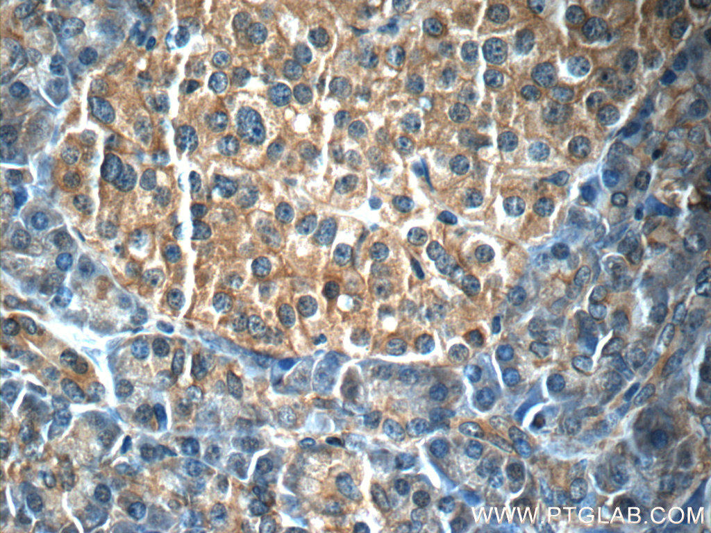 Immunohistochemistry of paraffin-embedded human pancreas tissue slide using 66196-1-Ig( IL23A Antibody) at dilution of 1:50 (under 40x lens)