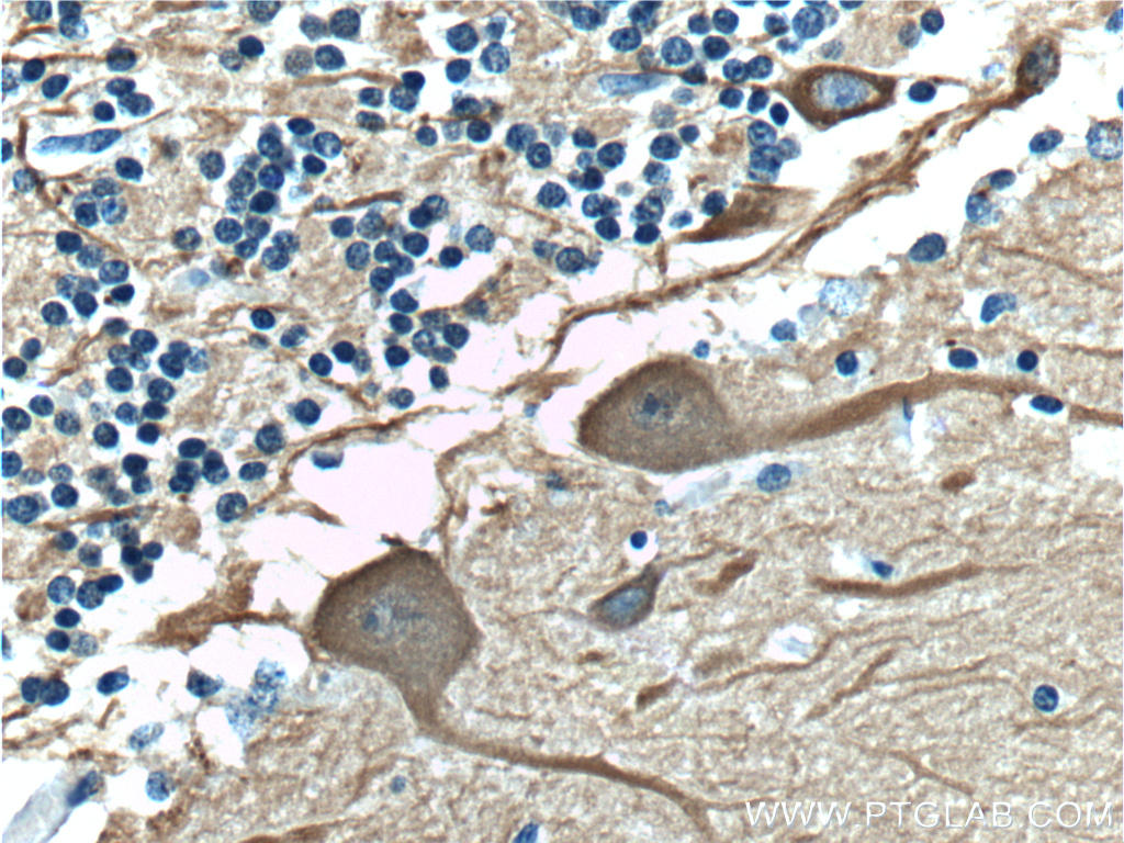 Immunohistochemistry of paraffin-embedded human cerebellum tissue slide using 66375-1-Ig (TUBB3-specific Antibody) at dilution of 1:400 (under 40x lens).