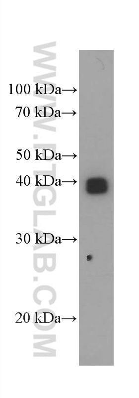 human placenta tissue were subjected to SDS PAGE followed by western blot with 66447-1-Ig( HLA-G Antibody) at dilution of 1:5000  incubated at room temperature for 1.5 hours