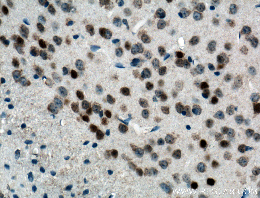 Immunohistochemical analysis of paraffin-embedded mouse brain tissue slide using 66590-1-Ig (FOS antibody) at dilution of 1:500 (under 40x lens. Heat mediated antigen retrieval with Tris-EDTA buffer (pH 9.0).