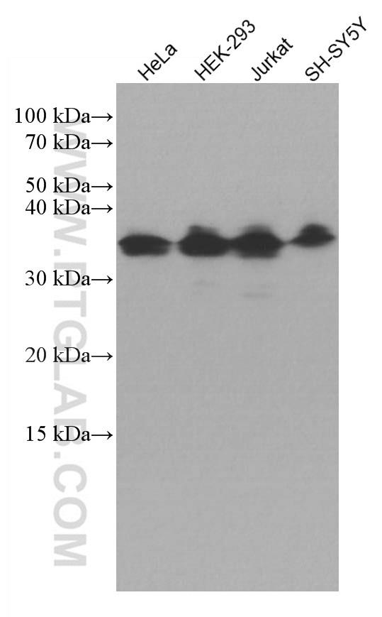 Various lysates were subjected to SDS PAGE followed by western blot with 67066-1-Ig (ATF5 antibody) at dilution of 1:3000 incubated at room temperature for 1.5 hours.