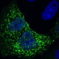 Immunofluorescence of HeLa cells transiently expressing HA-TOMM70