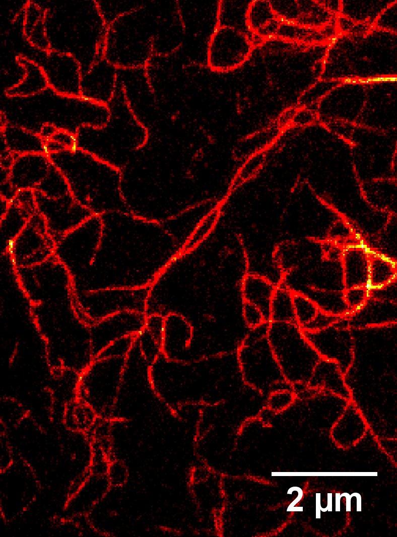 STED microscopy of Vimentin filaments. Vero cells expressing Vimentine-Citrine were immunostained with GFP-Booster (image kindly provided by F. Winter, dept. NanoBiophotonics, MPI-bpc, Goettingen).