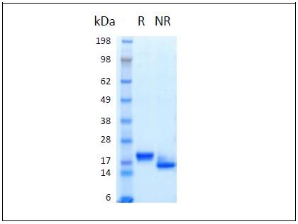 The protein was resolved by SDS-polyacrylamide gel electrophoresis and the gel was stained with Coomassie blue. R represents reducing conditions and NR represents non-reducing conditions.
