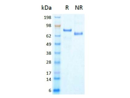 The protein was resolved by SDS- polyacrylamide gel electrophoresis and the gel was stained with Coomassie blue. R represents reducing conditions and NR represents non-reducing conditions.