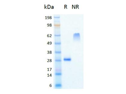 The protein was resolved by SDS polyacrylamide gel electrophoresis and the gel was stained with Coomassie blue. R represents reducing conditions and NR represents non-reducing conditions.