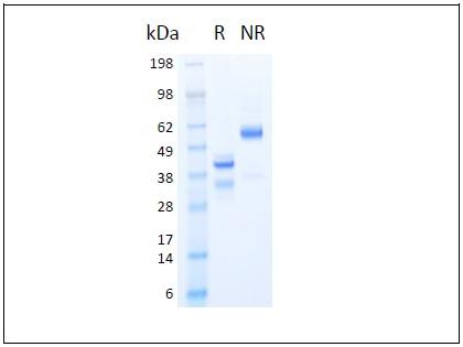 The protein was resolved by SDS polyacrylamide gel electrophoresis and the gel was stained with Coomassie blue. R represents reducing conditions and NR represents non-reducing conditions.