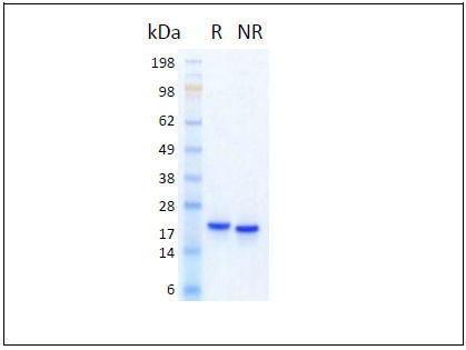 The protein was resolved by SDS-polyacrylamide gel electrophoresis and the gel was stained with Coomassie blue. R represents reducing conditions and NR represents non-reducing conditions.