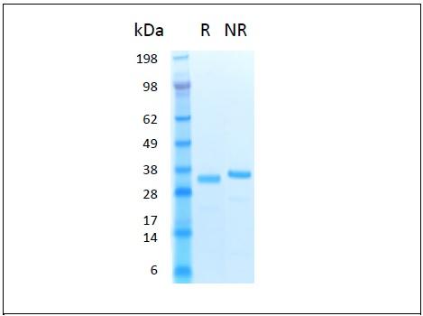 The protein was resolved by SDS-polyacrylamide gel electrophoresis and the gel was stained with Coomassie blue.. R represents reducing conditions and NR represents non-reducing conditions.