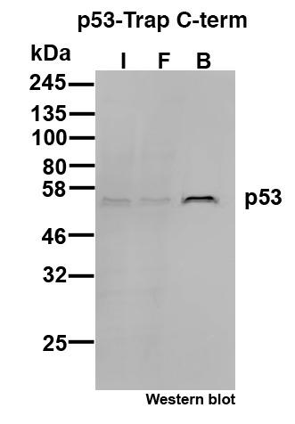 p53-C-term-Trap Agarose for Immunoprecipitation of p53. I: Input, FT: Flow-through, B: Bound