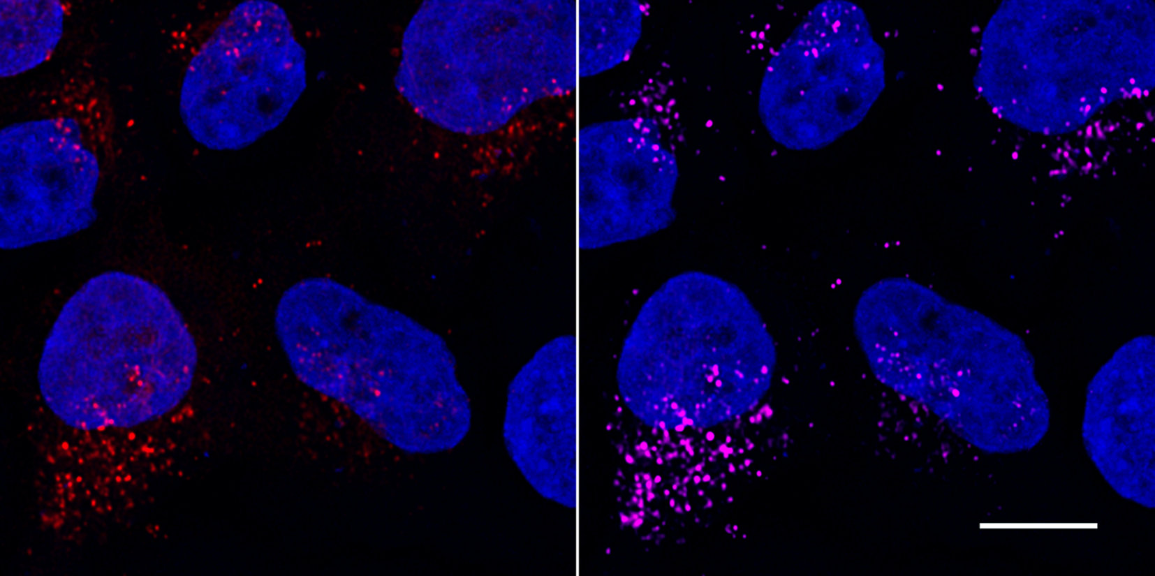 Confocal images of HeLa cells transiently transfected with LC3B-mCherry (red) and immunostained with RFP-Booster Alexa Fluor647 (magenta). Nuclei were stained with DAPI (blue). Scale bar, 10 µm. Images were recorded at the Core Facility Bioimaging at the Biomedical Center, LMU Munich.