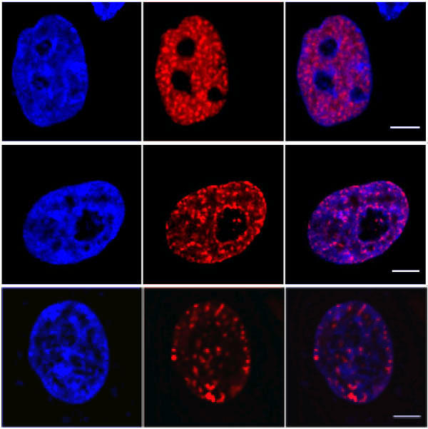 RFP-Booster specifically labels RFP-fusion proteins. HeLa cells expressing mRFP-PCNA, fixed and permeablilized. Specific staining of mid replication foci with RFP-Booster.