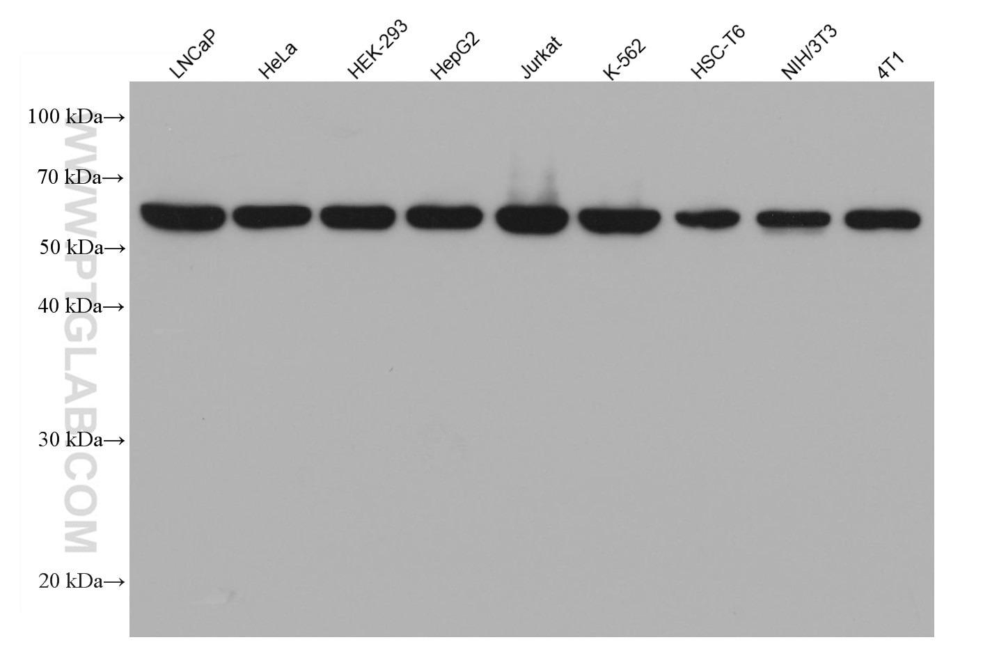 様々なライセートとMulti-rAb HRP標識抗マウスIgG二次抗体を用いたU2AF2の化学発光ウェスタンブロット（WB）結果
