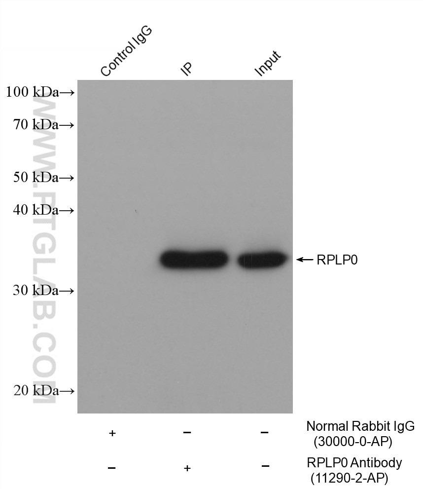 IP-WBにおける立体構造特異的二次抗体を用いたRPLP0タンパク質の検出