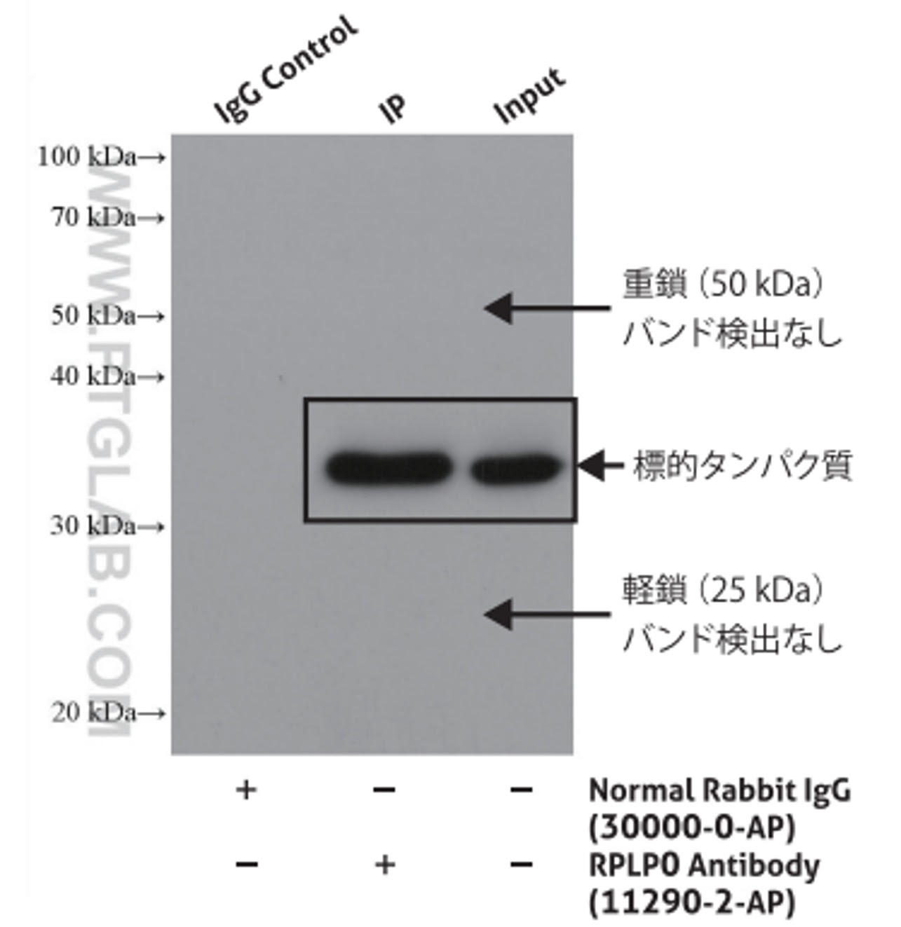 構造特異的二次抗体を用いたIP-WB結果