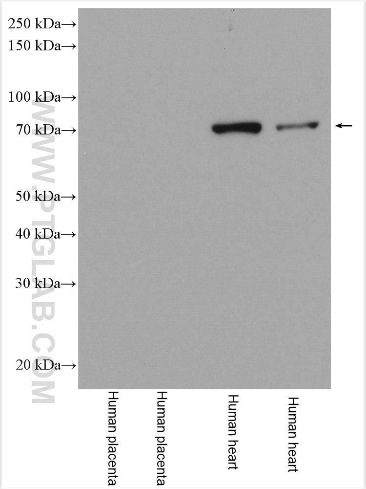 Various lysates were subjected to SDS PAGE followed by western blot with Biotin-60293 (OPTN antibody) at dilution of 1:1000 incubated at room temperature for 1.5 hours. SA00001-0 (HRP-conjugated Streptavidin) as secondary antibody, at dilution of 1:3000 (lane 1 and 3) or 1:6000 (lane 2 and 4).