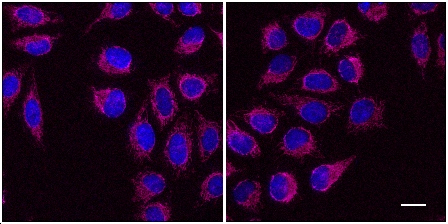 One-step staining (left) vs. sequential staining (right) of HeLa cells with anti-COX4 (mitochondria) mouse IgG1 monoclonal primary antibody + Nano-Secondary alpaca anti-mouse IgG1 Alexa Fluor® 647 (magenta). Cell nuclei are stained with DAPI (blue). Scale bar, 20 µm.