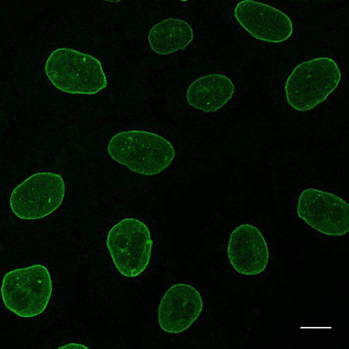 Immunostaining of Lamin in HeLa cells with mouse anti-Lamin A/C antibody and Nano-Secondary® alpaca anti-mouse IgG2b, recombinant VHH, Alexa Fluor® 488 [CTK0105,CTK0106] 1:1,000 (green). Scale bar, 10 µm.