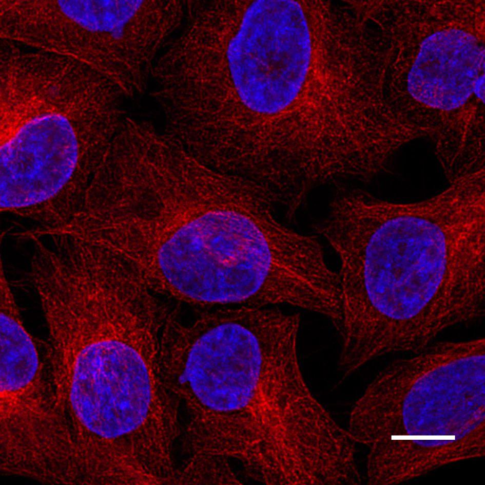 Immunostaining of β-Tubulin in HeLa cells with mouse anti-β-Tubulin antibody and Nano-Secondary® alpaca anti-mouse IgG2b, recombinant VHH, Alexa Fluor® 568[CTK0105, CTK0106] 1:1,000 (red). Nuclei were stained with DAPI (blue). Scale bar, 10
µm.