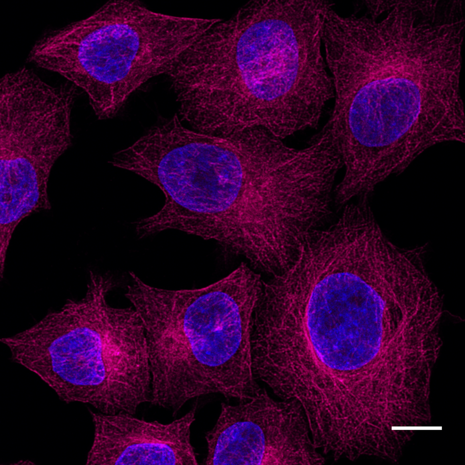 Immunostaining of β-Tubulin in HeLa cells with mouse anti-β-Tubulin antibody and Nano-Secondary® alpaca anti-mouse IgG2b, recombinant VHH, Alexa Fluor® 647[CTK0105, CTK0106] 1:1,000 (magenta). Nuclei were stained with DAPI (blue). Scale bar,10 µm.