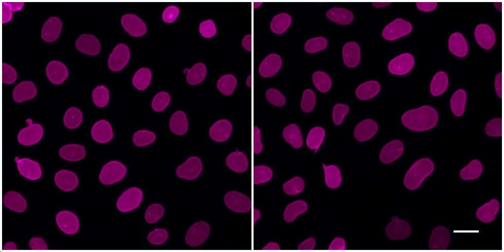 One-step staining (left) vs. sequential staining (right) of HeLa cells with anti-Lamin A/C (nuclear lamina) mouse IgG2b monoclonal primary antibody + Nano-Secondary alpaca anti-mouse IgG2b Alexa Fluor® 647 (magenta). Scale bar, 20 µm