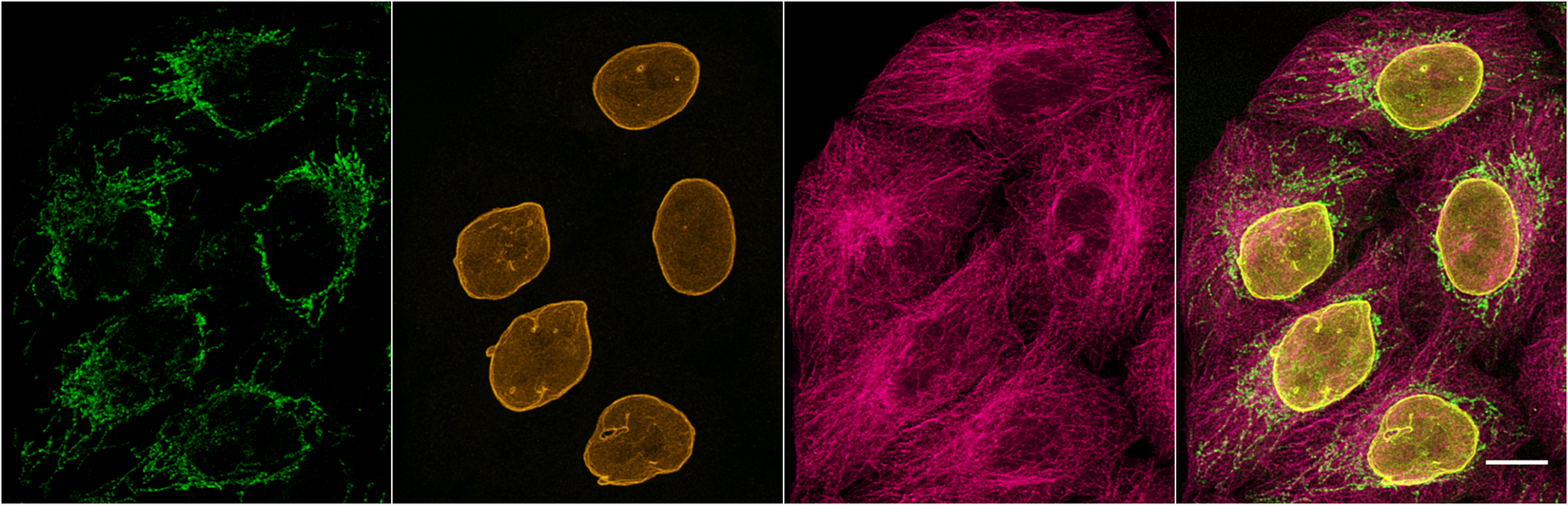 Multiplexed immunostaining of HeLa cells with two alpaca anti-mouse Nano-Secondaries and one anti-rabbit Nano-Secondary. Green: mouse IgG1 anti-COX4 + Nano-Secondary alpaca anti-mouse IgG1 Alexa Fluor® 488. Yellow: rabbit anti-Lamin + Nano-Secondary alpaca anti-rabbit IgG Alexa Fluor® 568. Magenta: mouse IgG2b anti-Tubulin + Nano-Secondary alpaca anti-mouse IgG2b Alexa Fluor® 647. Scale bar, 10 µm. Images were recorded at the Core Facility Bioimaging at the Biomedical Center, LMU Munich.