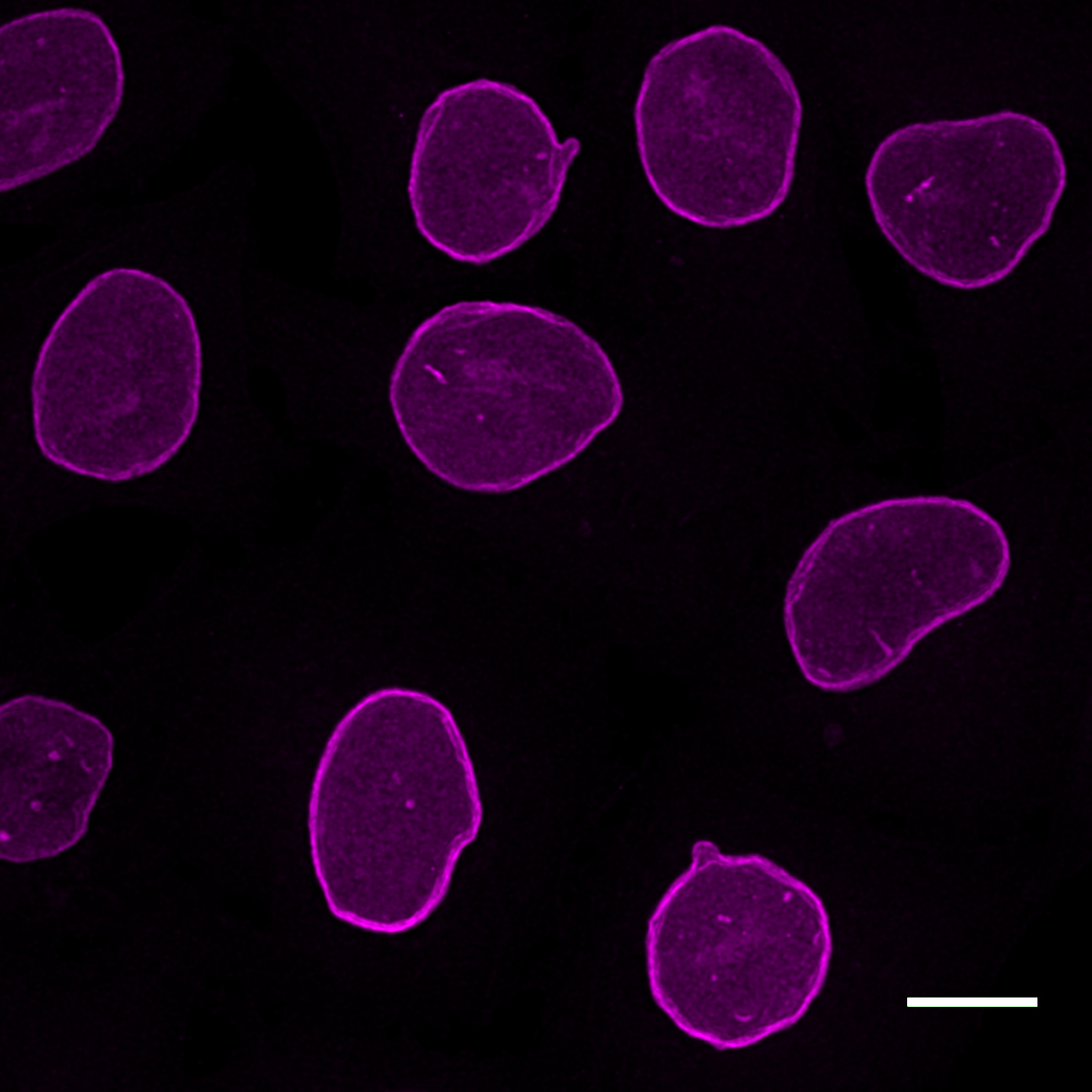 HeLa cells were immunostained with mouse IgG3 anti-Lamin A/C antibody +Nano-Secondary alpaca anti-mouse IgG3 Alexa Fluor® 647 (magenta). Scale bar, 10 µm. Images were recorded at the Core Facility Bioimaging at the Biomedical Center, LMU Munich.