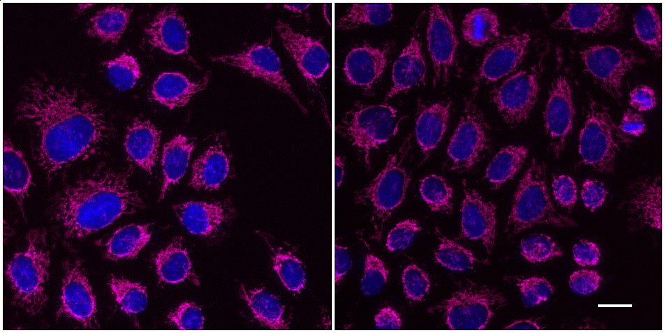 One-step staining (left) vs. sequential staining (right) of HeLa cells with anti-MOT (mitochondria) mouse IgG3 monoclonal primary antibody + Nano-Secondary alpaca anti-mouse IgG3 Alexa Fluor® 647 (magenta). Cell nuclei are stained with DAPI (blue). Scale bar, 20 µm.