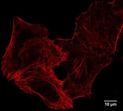 STED: IF of Spot-tagged Actin-Chromobody with Spot-Label Atto594 bivalent (1:1,000). Gated STED images were acquired with a Leica TCS SP8 STED 3X microscope with pulsed White Light Laser excitation at 590 nm and pulsed depletion with a 775 nm laser. Objective: 100x Oil STED White, NA: 1.4. Pixel size: 21 x 21 nm; z-Step size of z-Stacks: 0.16 µm. Images were deconvolved with Huygens Professional (SVI). STED images were recorded at the Core Facility Bioimaging at the Biomedical Center, LMU Munich.