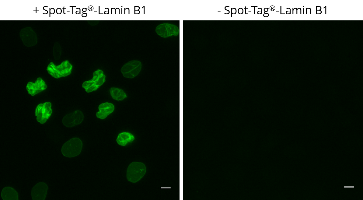 Left: HeLa cells transiently expressing Spot-Tag®-Lamin B1 were immunostained with Spot-Label® Alexa Fluor® 488 (ebAF488, 1:800). Right: Control staining of untransfected cells. Scale bar, 10 µm. Images were acquired with the Thermo Scientific CellInsight CX7, 20X objective