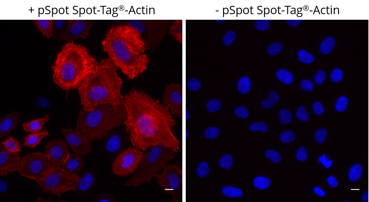 Left: HeLa cells transiently expressing pSpot Spot-Tag®-Actin (ev-31) were immunostained with Spot-Label® Alexa Fluor® 568 (red, ebAF568, 1:800) and DAPI (blue). Right: Control staining with Spot-Label® Alexa Fluor® 568 (red, ebAF568, 1:800) and DAPI (blue) of untransfected HeLa cells showing no unspecific background. Scale bar, 10 µm. Images were acquired with the Thermo Scientific CellInsight CX7, 20X objective.