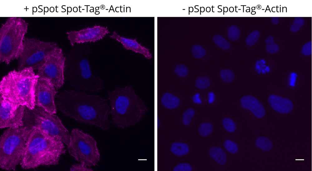 Left: HeLa cells transiently expressing pSpot Spot-Tag®-Actin (ev-31) were immunostained with Spot-Label® Alexa Fluor® 647 (magenta, ebAF647, 1:800) and DAPI (blue). Right: Control staining, no background noise; HeLa cells without pSpot Spot-Tag®-Actin expression were immunostained with Spot-Label® Alexa Fluor® 647 (magenta, ebAF647, 1:800) and DAPI (blue). Scale bar, 10 µm. Images were acquired with the Thermo Scientific CellInsight CX7, 20X objective.