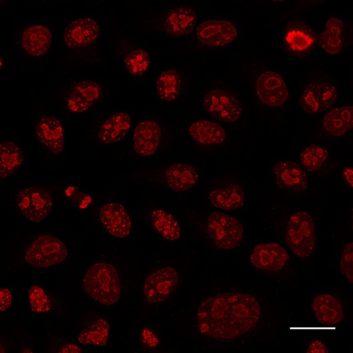 Immunostaining of Ki67 in HeLa cells with rabbit anti-Ki67 antibodies and Nano-Secondary® alpaca anti-human IgG/anti-rabbit IgG, recombinant VHH, Alexa Fluor®568 [CTK0101, CTK0102] 1:1,000 (red). Scale bar, 20 µm.