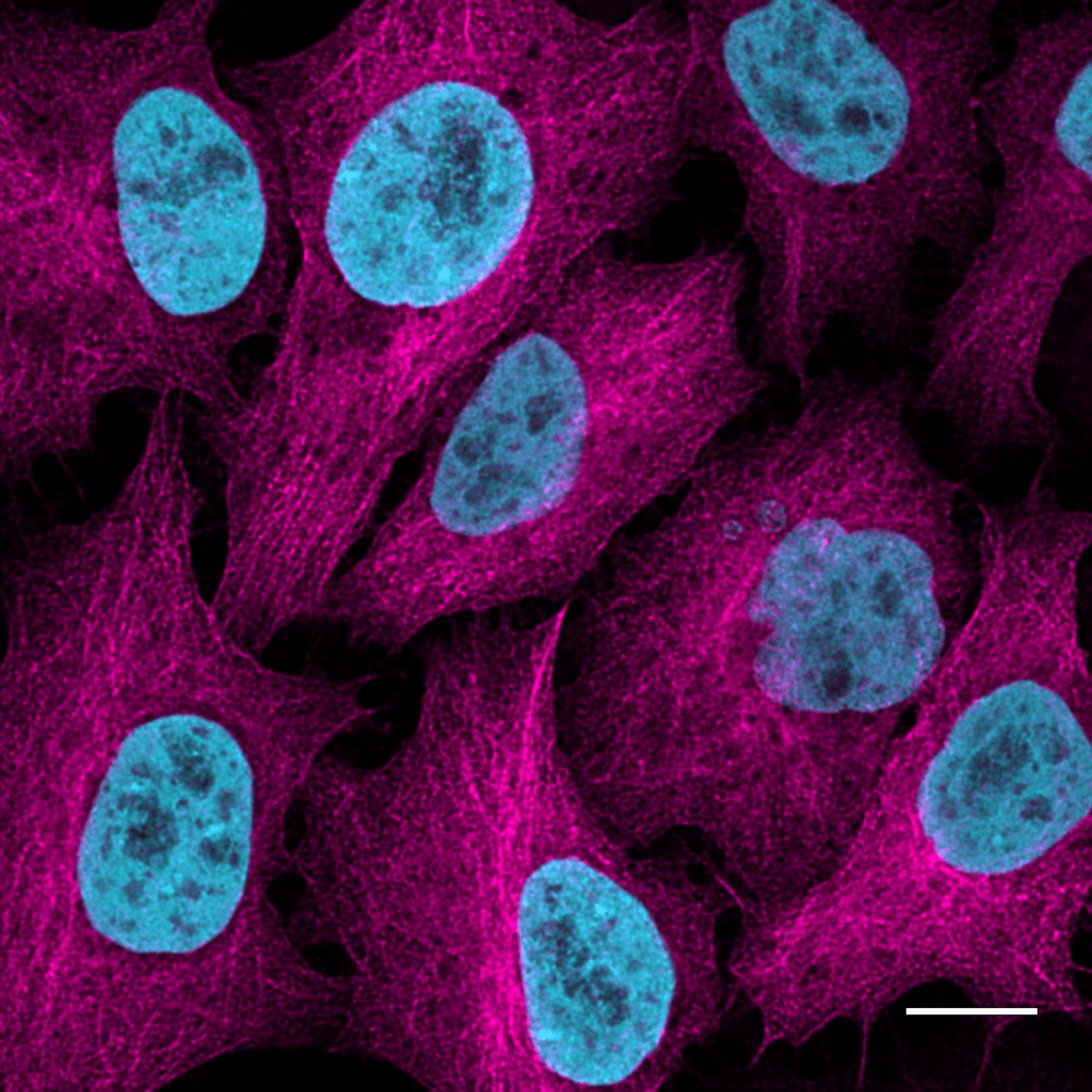 Immunostaining of HeLa cells stably expressing Tubulin-GFP at near-endogenous levelwith GFP antibody rabbit polyclonal [PABG1] (PABG1, ChromoTek) 1:1,000 and Nano-Secondary® alpaca anti-human IgG/anti-rabbit IgG, recombinant VHH, Alexa Fluor®647 [CTK0101, CTK0102] 1:1,000 (magenta). Nuclei were detected with H2B-RFP andRFP-Booster Atto594 (cyan). Scale bar, 20 µm.