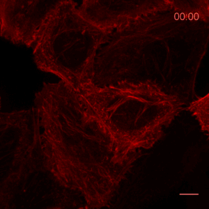 The time lapse analysis reveals the reorganization of actin after treatment with Cytochalasin D: HeLa cells were subjected to confocal imaging upon treatment with 2 µM of Cytochalasin D for 1 hour and recovery for 4 hours. Actin Chromobody enables monitoring of actin dynamics in real-time in living cells.