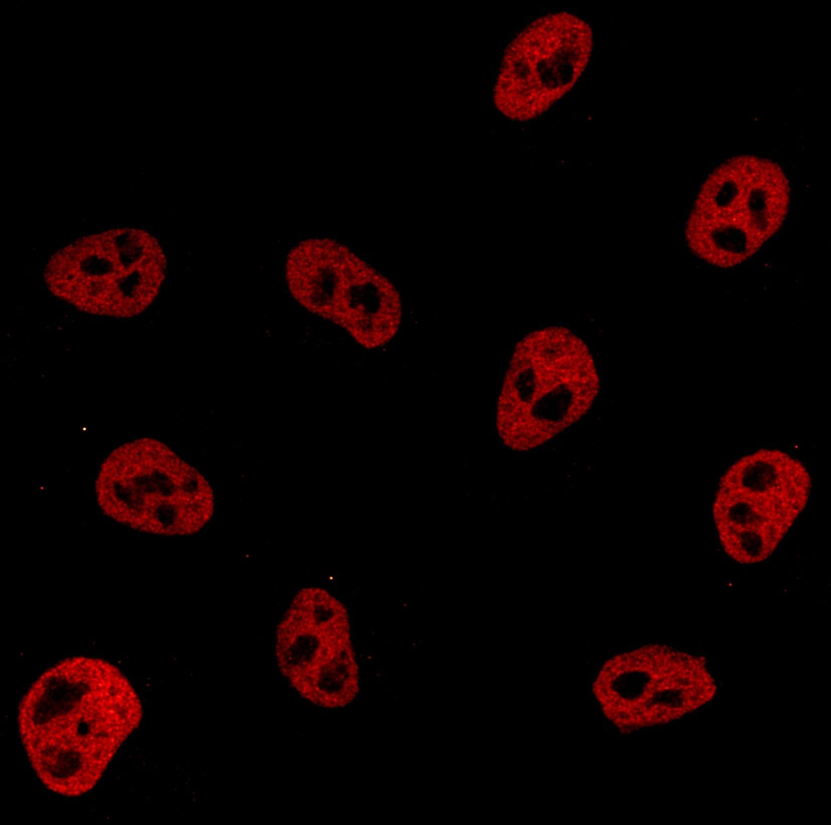 PFA固定HeLa細胞の免疫蛍光染色。オレンジ：FlexAble CoraLite® Plus 555 Kit（品番：KFA062）で標識したHDAC2抗体（品番：67165-1-Ig）。